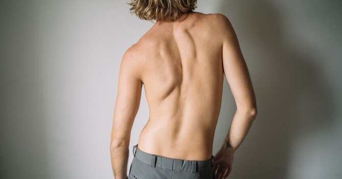 Scoliosis and Chiropractic Care